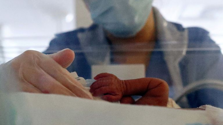 A premature baby is cared for at Burnley General Hospital