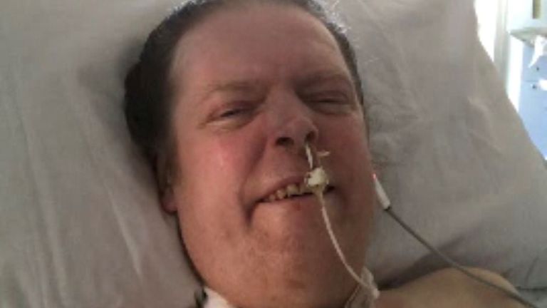 جیسون کلک پس از ابتلا به COVID-19 از آوریل سال گذشته از دستگاه تنفس استفاده کرده است.  عکس: سو کلک