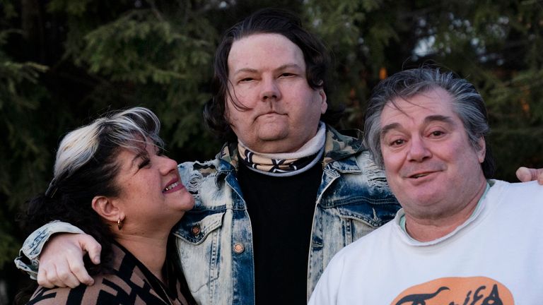 Joe DiMeo stands with his parents Rose and John in the backyard of their home in Clark, N.J., Thursday, Jan. 28, 2021, six months after an extremely rare double hand and face transplant. “In the future, I have a lot more plans for myself,” he said. “You got a new chance at life. You really can’t give up.” (AP Photo/Mark Lennihan)