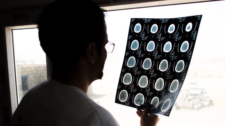 The earlier cancer is diagnosed the higher the survivability Pic: AP