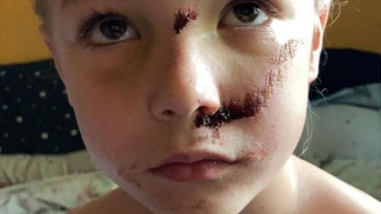 Six-year-old Jamie Smith suffered a fractured skull after being hit by an e-scooter rider. Pic: Leicestershire Police