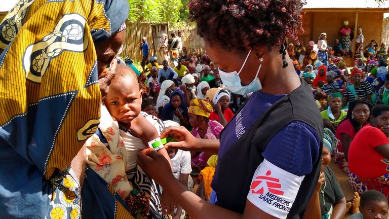 In this photo dated Friday Feb. 19, 2021, made available by Medecins Sans Frontieres, showing an MSF (Doctors Without Borders) staff member measuring a child&#39;s upper arm circumference to check for malnutrition in Meluco, in the northern Mozambican province of Cabo Delgado. Northern Mozambique&#39;s humanitarian crisis is quickly growing with more than 650 000 people displaced by the Islamic extremist insurgency in Cabo Delgado province according to a statement Tuesday March 16, 2021, from Internatio