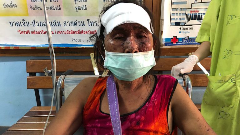 Bea Tu was injured in an airstrike on Saturday