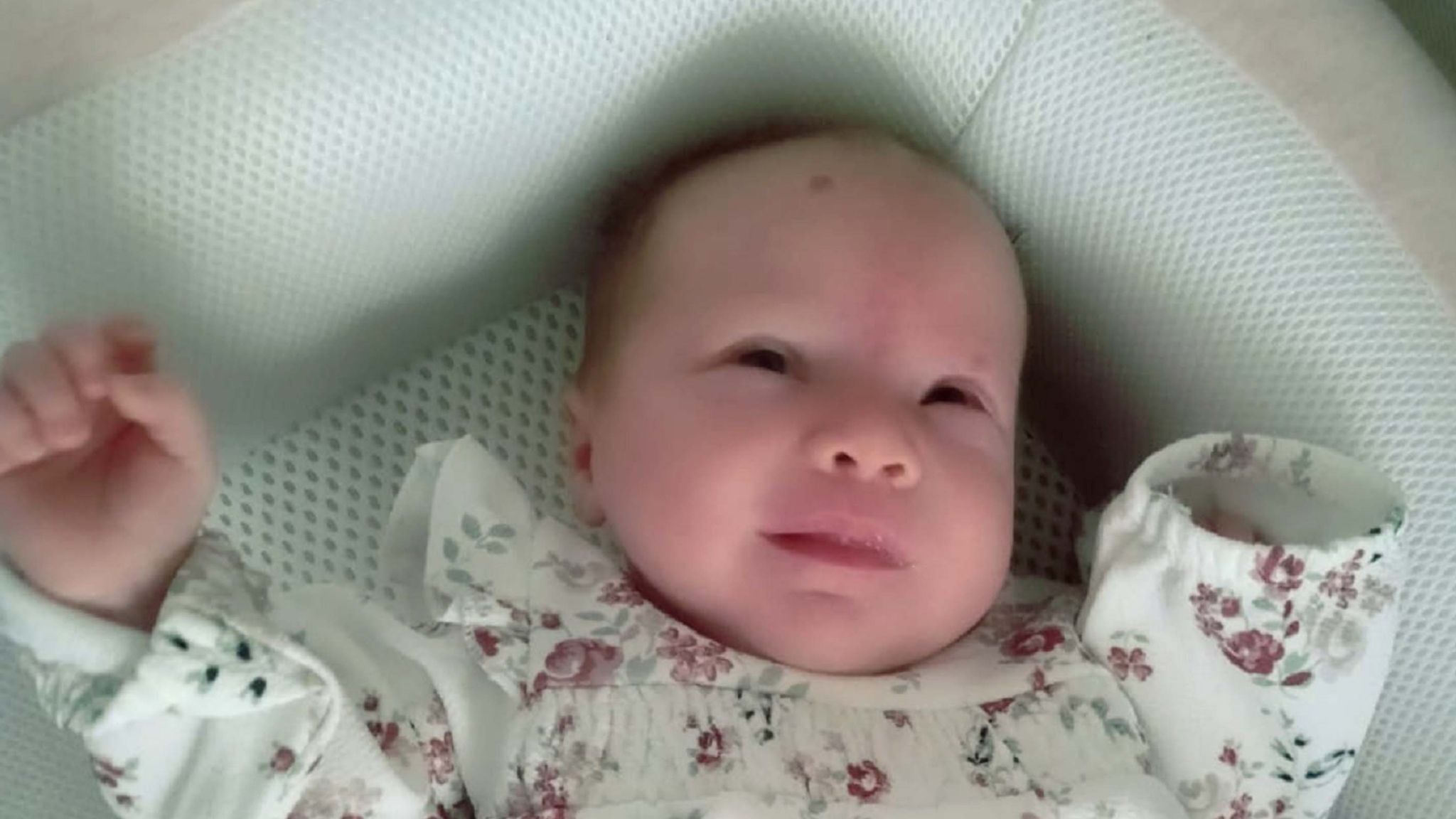 Dozens Of Babies With Spina Bifida Spared Paralysis Thanks To Mind Blowing Surgery In Womb Science Tech News Sky News