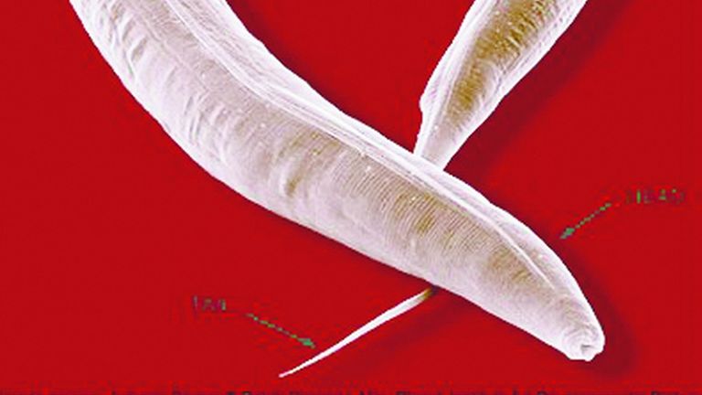 Caenorhabditis elegans share many of the same biological characteristics as humans Pic: AP