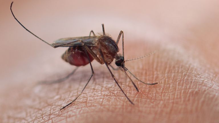 Malaria is common contracted through mosquito bites
