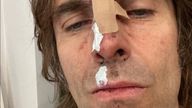 Liam Gallagher has claimed he fell out of a helicopter following his headline set at the Isle Of Wight Festival. Pic: @liamgallagher