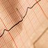 Our heartbeats synchronise while we're listening to stories, researchers find