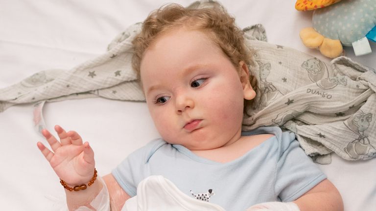 Marley Powell recovers at Sheffield Children&#39;s Hospital having received the "most expensive drug in the world", the genetic treatment Zolgensma. Picture date: Wednesday September 15, 2021.