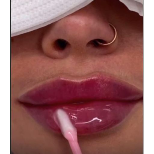 Fillers, false advertising and intimidation: The ugly side of the aesthetic training industry