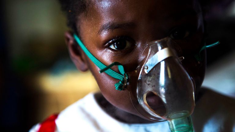 A young girl has treatment for her severe asthma provided through a mask. File pic by AP
