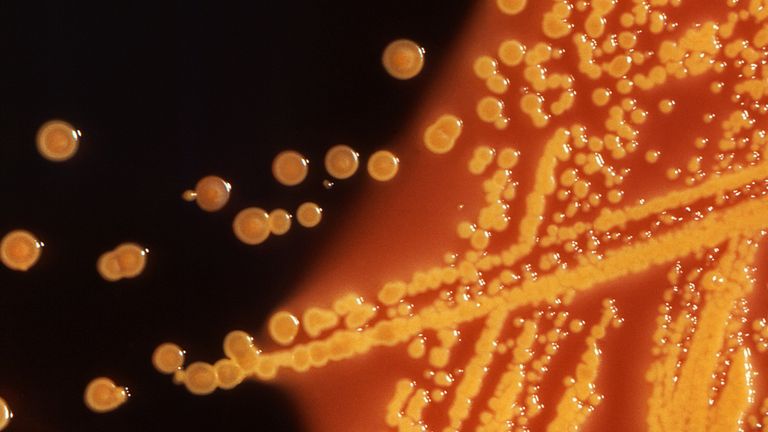 Colonies of E. coli bacteria are seen in a microscopic image. File Pic