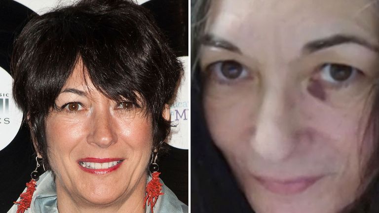A photo of Ghislaine Maxwell with a &#39;black eye&#39; was released by her lawyer in April