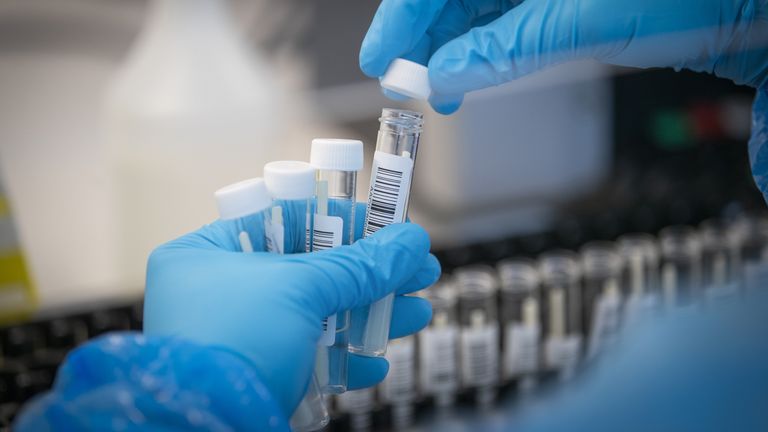 Les échantillons de patients sont transférés par les scientifiques dans des plaques avant d'entrer dans le processus de PCR (Polymerase Chain Reaction)