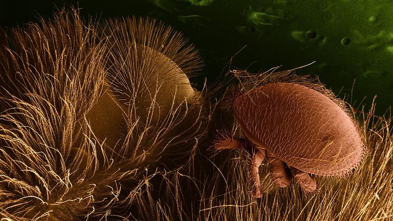 Low-temperature scanning electron micrograph of Varroa destructor on a honey bee host
