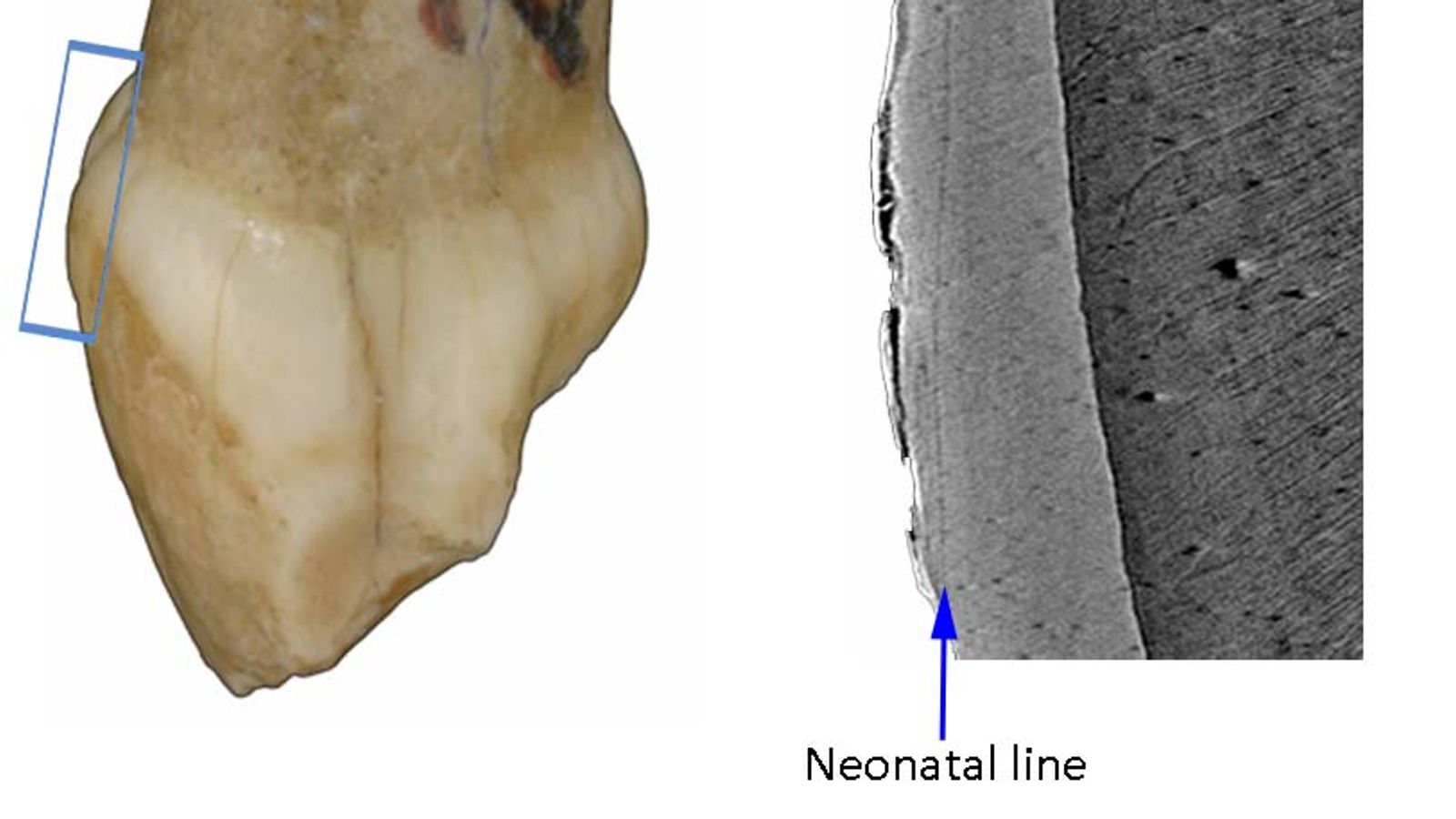 Neanderthal children may have cut their teeth earlier than modern humans