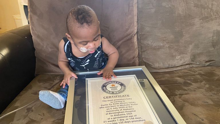 A US boy born at 21 weeks and a day weighing under a pound has been certified as the world&#39;s most premature baby to survive.
Curtis Means was delivered in Birmingham, Alabama  weighing just 420g (14.8 ounces).
PIC: GUINNESS WORLD RECORDS