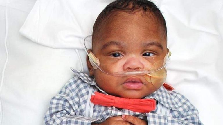 A US boy born at 21 weeks and a day weighing under a pound has been certified as the world&#39;s most premature baby to survive.
Curtis Means was delivered in Birmingham, Alabama  weighing just 420g (14.8 ounces).
PIC: GUINNESS WORLD RECORDS