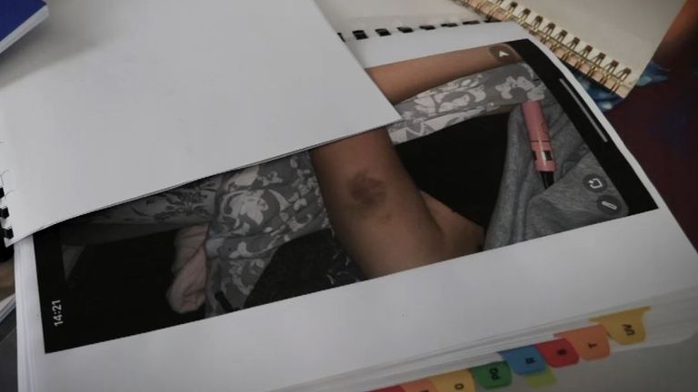 Sky News a vu des preuves fournies par Sarah, y compris des photos des blessures qu'elle a subies
