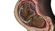 Illustration of black foetus by Chidiebere Sunday Ibe. Pic: Chidiebere Sunday Ibe