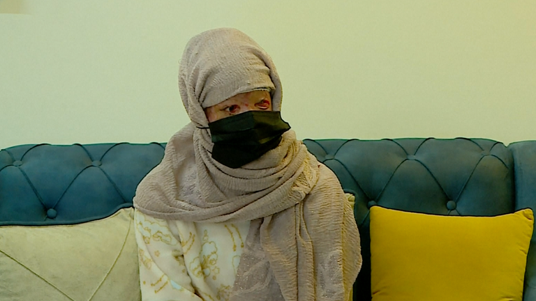 Baghdad Acid Attack Survivor Recounts Traumatic Incident