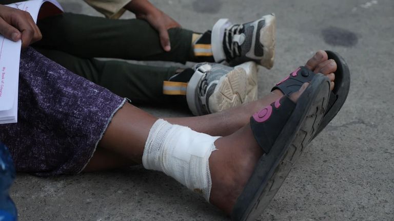 Bethlehem, yang berusia 9 tahun, kehilangan tendon Achilles-nya dan lukanya tidak kunjung sembuh. 