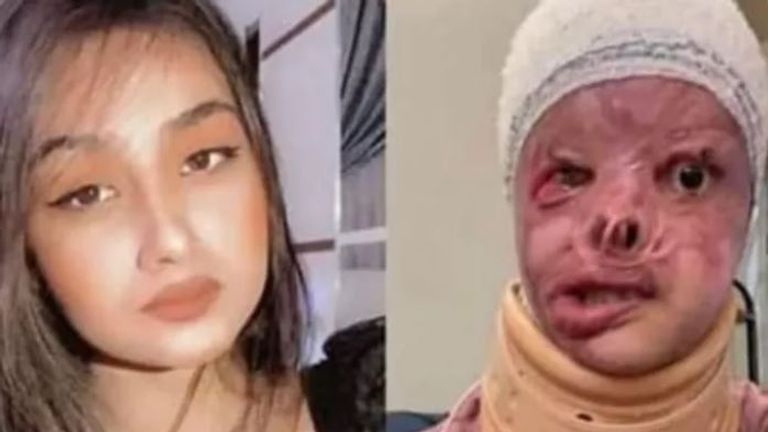 Maryam Rukabi before and after the attack