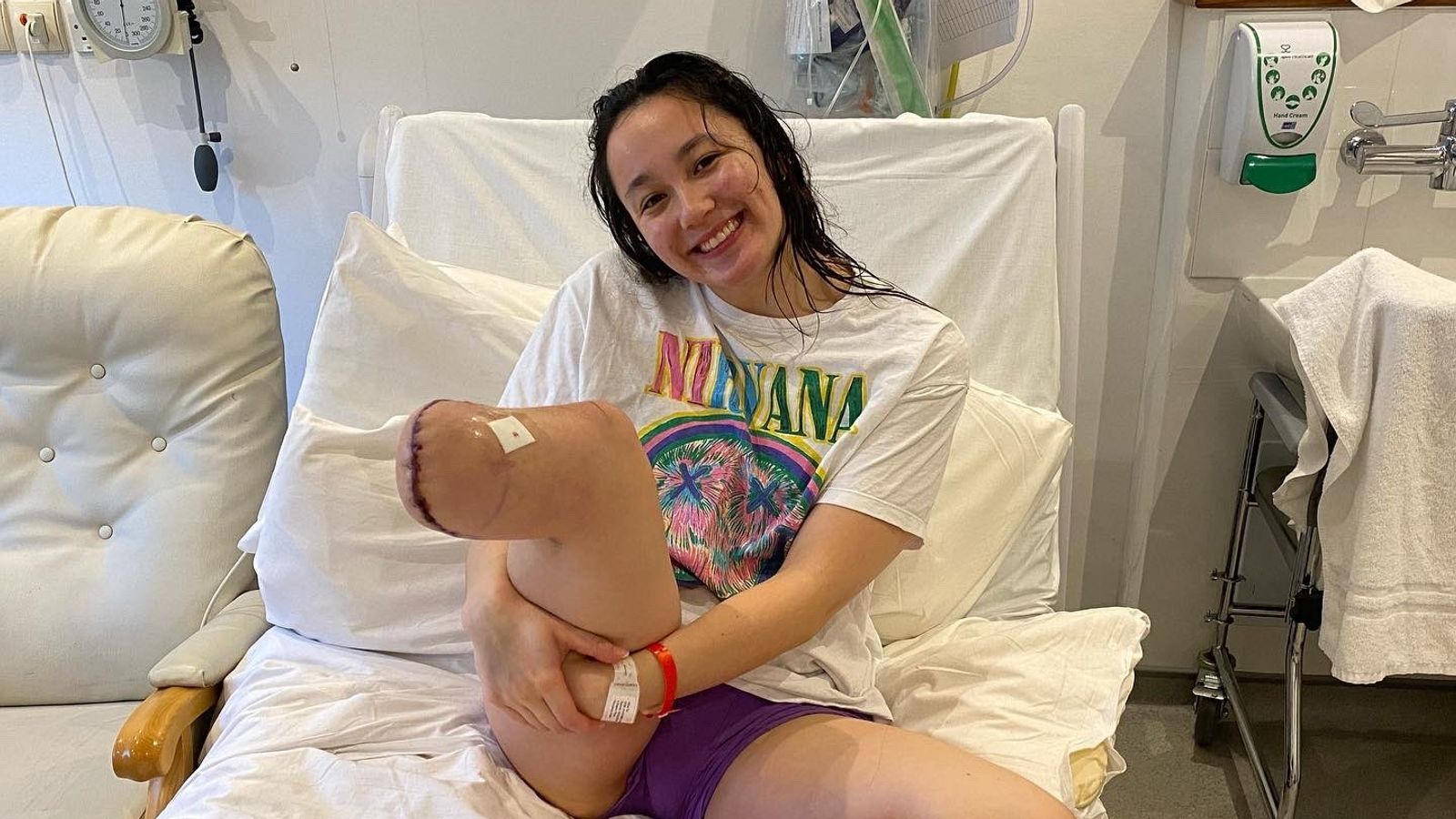 Paralympic swimming champion Alice Tai 'healthy, happy and thriving' after foot amputation