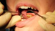 File photo dated 19/05/11 of a general view of a dentist at work. Mandatory jabs for healthcare worker could have a "devastating" consequence on stretched dental services, leading dentists have said.
