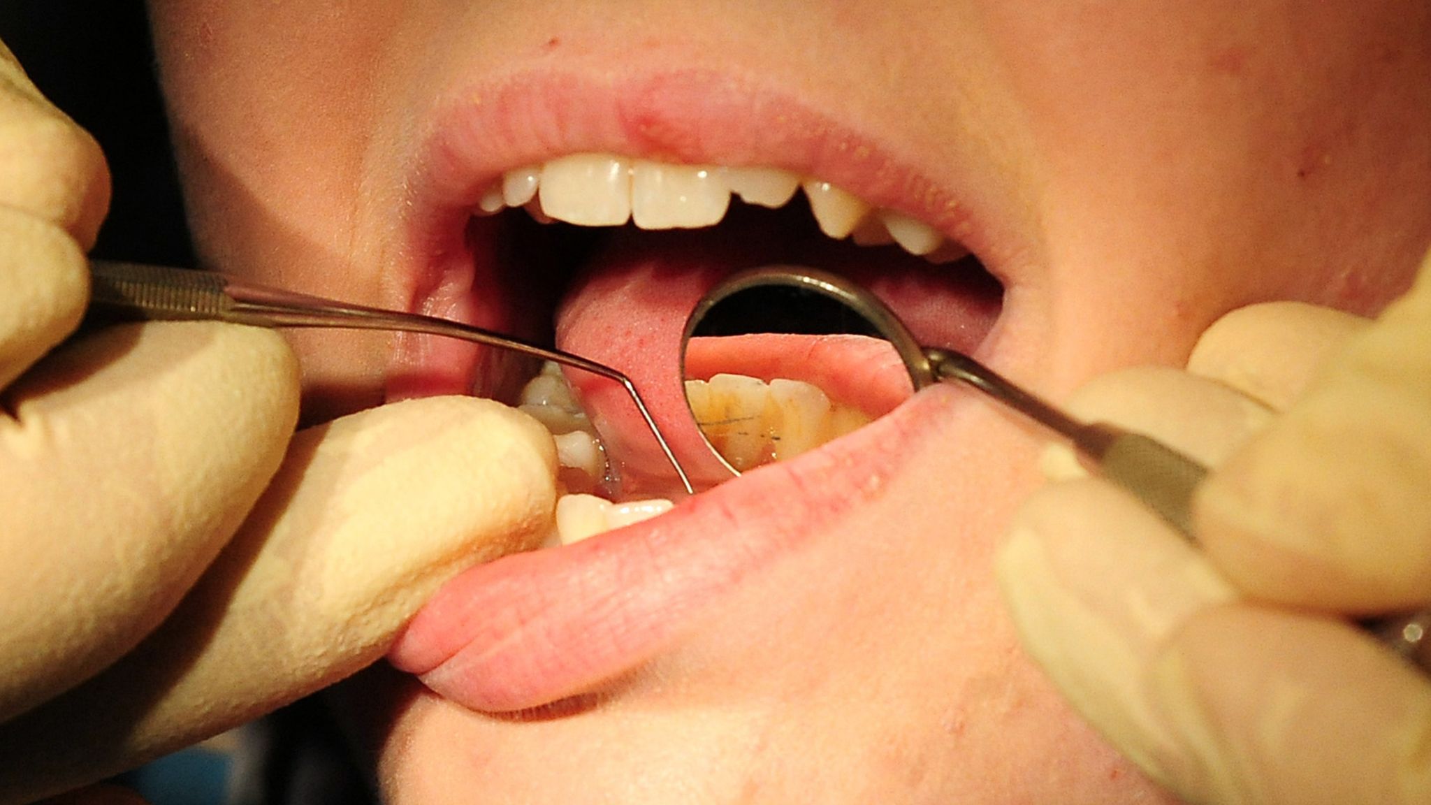 NHS dentistry 'will die' leaving patients with 'no options' if practices  continue to ditch health service ties, experts warn | UK News | Sky News