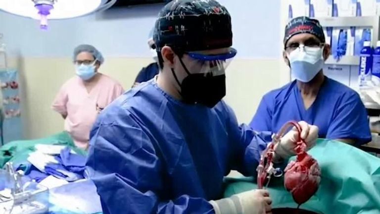 US doctors transplant pig heart into human