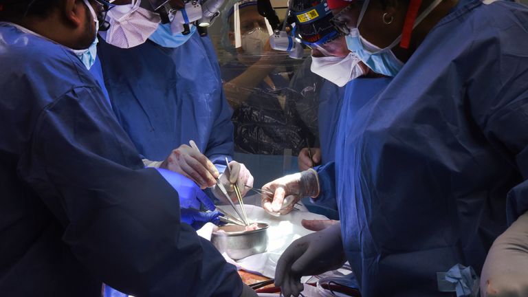 In this photo provided by the University of Maryland School of Medicine, members of the surgical team perform the transplant of a pig heart into patient David Bennett in Baltimore on Friday, Jan. 7, 2022. On Monday, Jan. 10, 2022 the hospital said that he&#39;s doing well three days after the highly experimental surgery. (Mark Teske/University of Maryland School of Medicine via AP)


