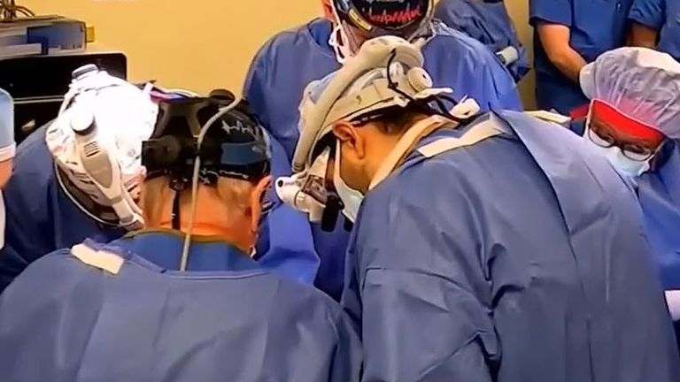 Doctors transplant a pig's heart into a human