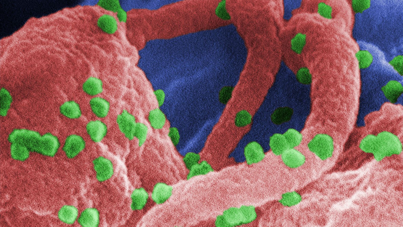 Надежди за излекуване на ХИВ след пробив с помощта на „ножици“ за редактиране на гени