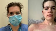 Dr Kelly Fearnley pictured before and after she contracted COVID 