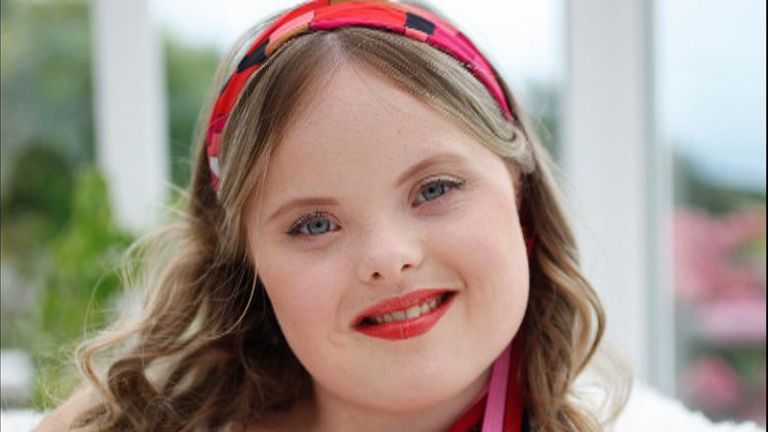 Model with Down&#39;s syndrome - Beth Matthews