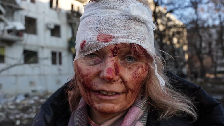 KHARKIV, UKRAINE - FEBRUARY 24: (EDITORS NOTE: Image depicts graphic content) A wounded woman is seen as airstrike damages an apartment complex outside of Kharkiv, Ukraine on February 24, 2022. (Photo by Wolfgang Schwan/Anadolu Agency via Getty Images) 
