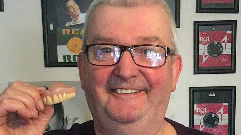 Undated handout photo by Paul Bishop of himself, as Mr Bishop, 63, from Stalybridge in Greater Manchester, has had his false teeth returned 11 years after he lost them in Benidorm thanks to a DNA database. Issue date: Thursday February 10, 2022.