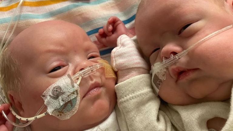 The twins now wait to be discharged from hospital, months after being prematurely born