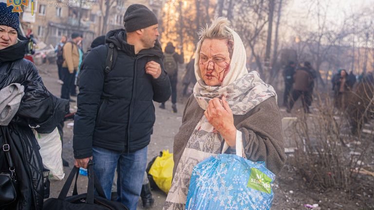 An injured woman walks from a building being evacuated after it is damaged by shelling in Kyiv