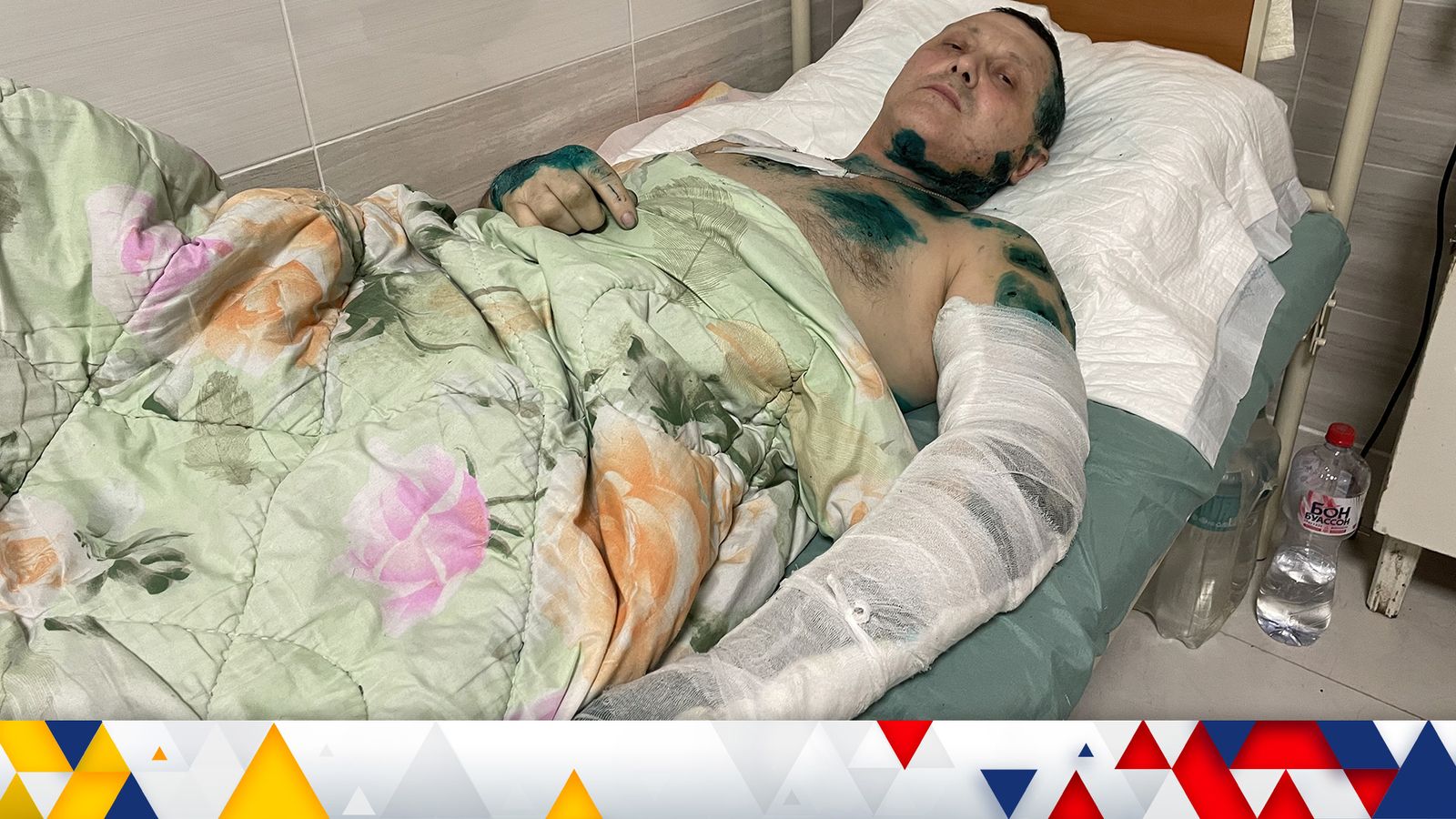 Guerre d’Ukraine : « Vous ne pouvez pas vous y habituer » – dans un hôpital de la ville déchiré par la guerre où les chirurgiens ont du mal à comprendre la sauvagerie russe |  Nouvelles du monde