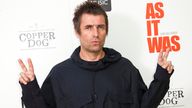 Singer Liam Gallagher says he needs a hip replacement