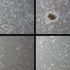 Turning back the clock: Human skin cells de-aged by 30 years in trial