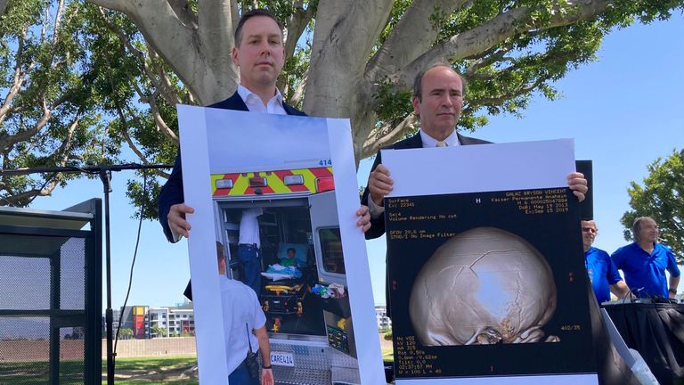 Attorney Keith Bruno, left, and Kyle Scott, representing the Galaz family, hold up a photo of Bryson Galaz and imaging of his skull. Pic: AP