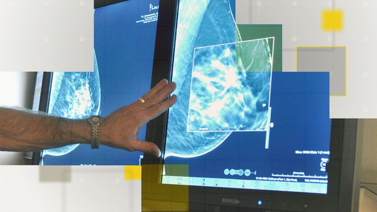 Cancer waiting times are at an all-time high