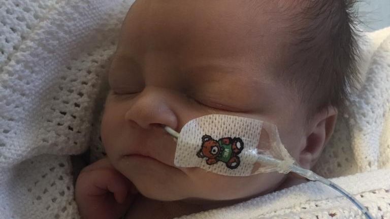 Doctors broke the news that her three-day-old Frank was critically ill with meningitis.