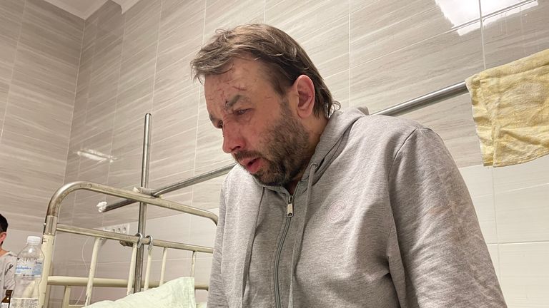 Un autre résident de l'immeuble, Vitali Vyhotsev, est devenu aveugle à cause de la deuxième explosion 