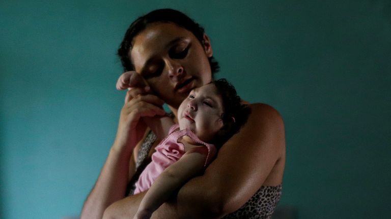 Zika is a risk to pregnant women and can cause microcephaly in their child