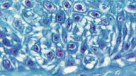 A magnified section of skin tissue that had been infected with the monkeypox virus. File pic