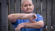 EMBARGOED TO 0001 THURSDAY MAY 26 Steven Gallagher, from Dreghorn, Ayrshire, is the first person in the world to have a double hand transplant after suffering from the rare disease scleroderma. Picture date: Tuesday May 24, 2022.